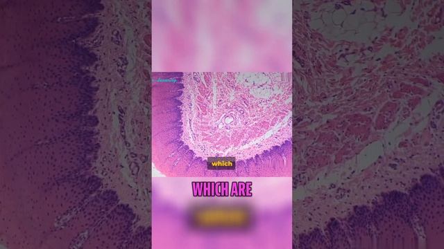 The Secrets of Carcinomas: Understanding Cancer Cells. смотреть онлайн