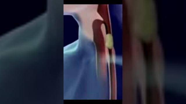 Digestive system смотреть онлайн