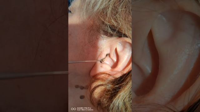 Серная пробка это ни есть плохо. Даже можно сказать что это хорошо.Это защита слухового прохода смотреть онлайн