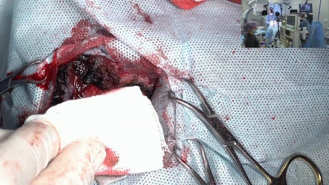 Новообразование головного мозга у кота смотреть онлайн
