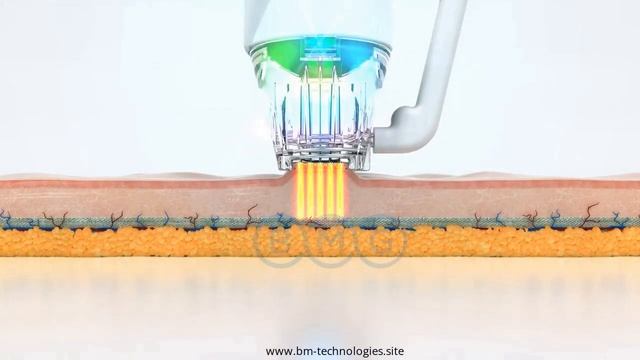 Eunsung Recell Ice BMG