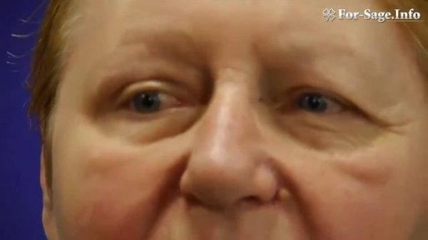 Полная презентация Ageless результаты применения отзывы гостей