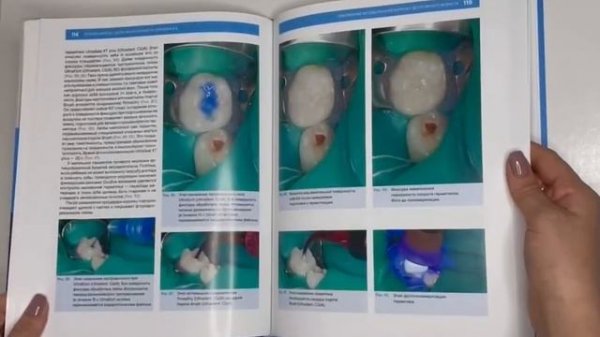 Корчагина В.В. Лечение кариеса у детей раннего возраста