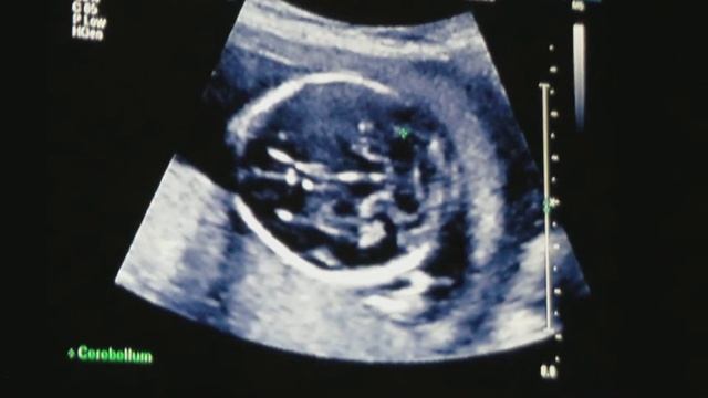 10-29-10 video 1 of 11 -- shows placenta; brain; baby's hiney, legs, and face.MOV смотреть онлайн
