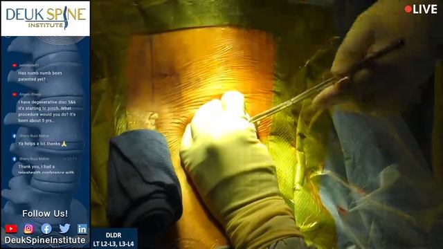 Watch Live Spine Surgery! Deuk Laser Disc Repair LT L2-L3, L3-L4 смотреть онлайн