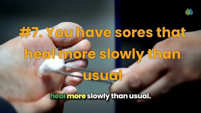 10 UNUSUAL Signs Your Blood Sugar is CONSTANTLY Too High смотреть онлайн