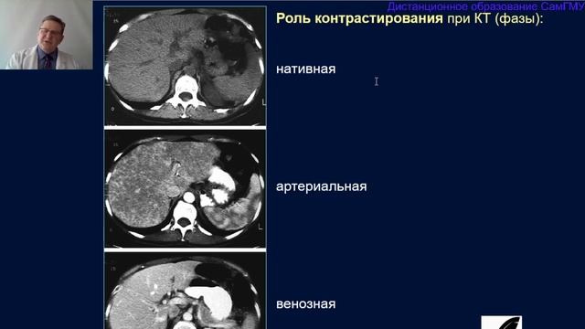 Лучевая диагностика заболеваний печени и гепатобилиарной системы  Часть 1  Лектор Капишников А В