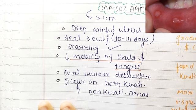 Recurrent Aphthous stomatitis | Part 2 | Clinical features, differential diagnosis смотреть онлайн