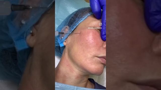 Полимолочка для кожи лица! смотреть онлайн