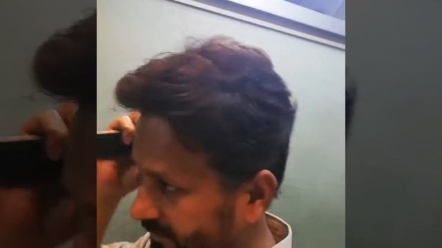 Non Surgical Hair Replacement 03229774834 03.04471544