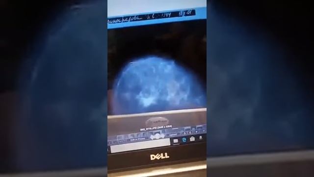 Маммограмма (онкология), Mammograms смотреть онлайн