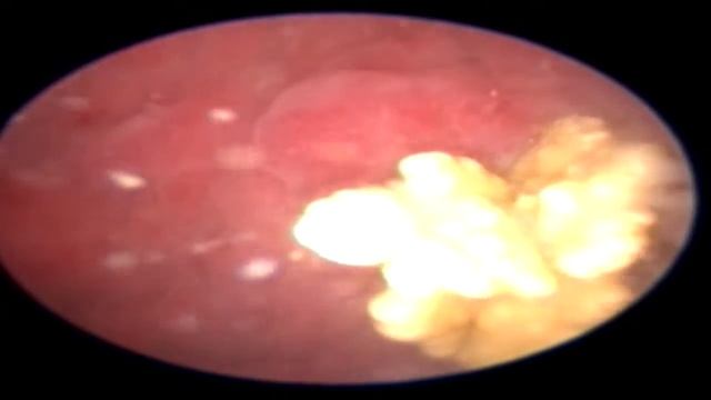 Цистоскопия Зета 8 лет/Cystoscopy in a dog. Cystotomy. Urolithiasis. Endoscopic examination. смотреть онлайн