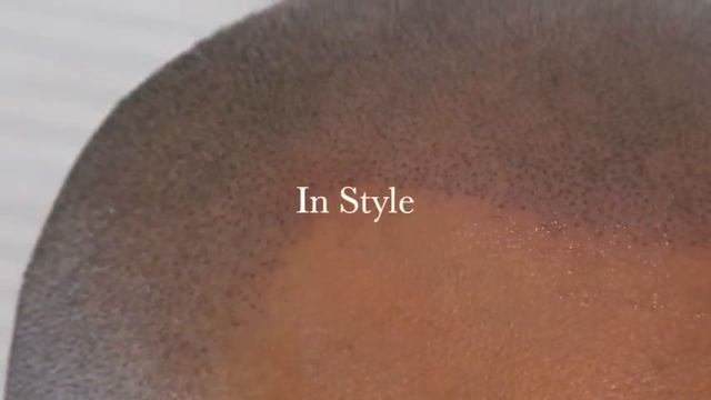 Good Look Ink Hair Replication for Hair Transplant Scars and Hair Loss смотреть онлайн