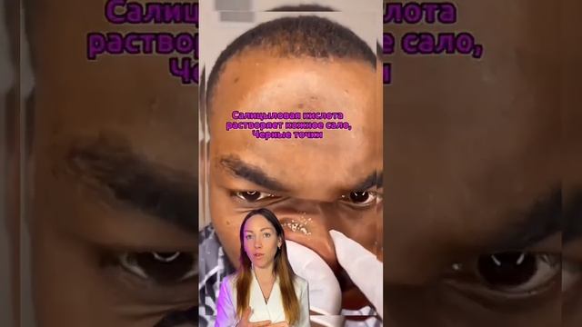 Как убрать черные точки ?