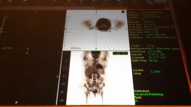 Brandi's PET scans смотреть онлайн
