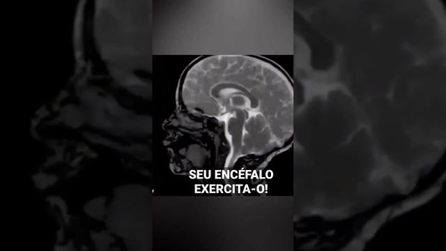 O encéfalo precisa ser estimulado e exercitado diariamente. #idosos #demencia #tratamentohumanizado смотреть онлайн