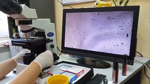 Как ВЫЛЕЧИТЬ ХРОНИЧЕСКИЙ ГАСТРИТ живыми спреями компании Alivemax элайфмакс эливемакс