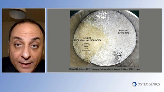 Dr. Raward Samarani “Aumento de cresta en 3D: ¿Es absolutamente necesario el hueso autógeno?” смотреть онлайн