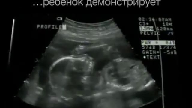Чудо жизни смотреть онлайн