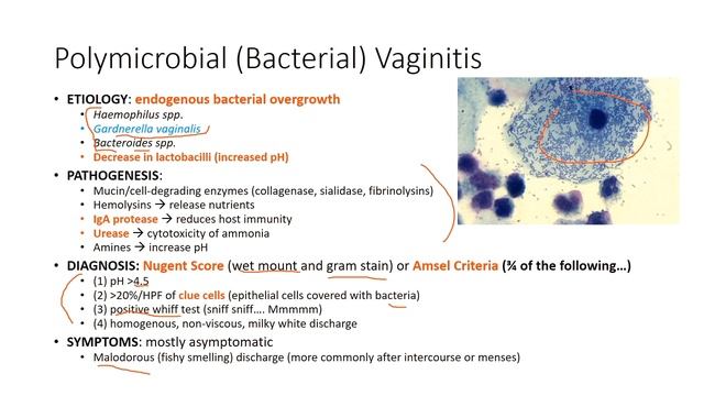 Urinary Tract and Sexually Transmitted Infections смотреть онлайн