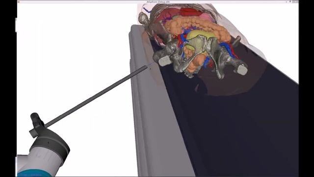 Acetabulum accessibility with Axilum Cobot смотреть онлайн
