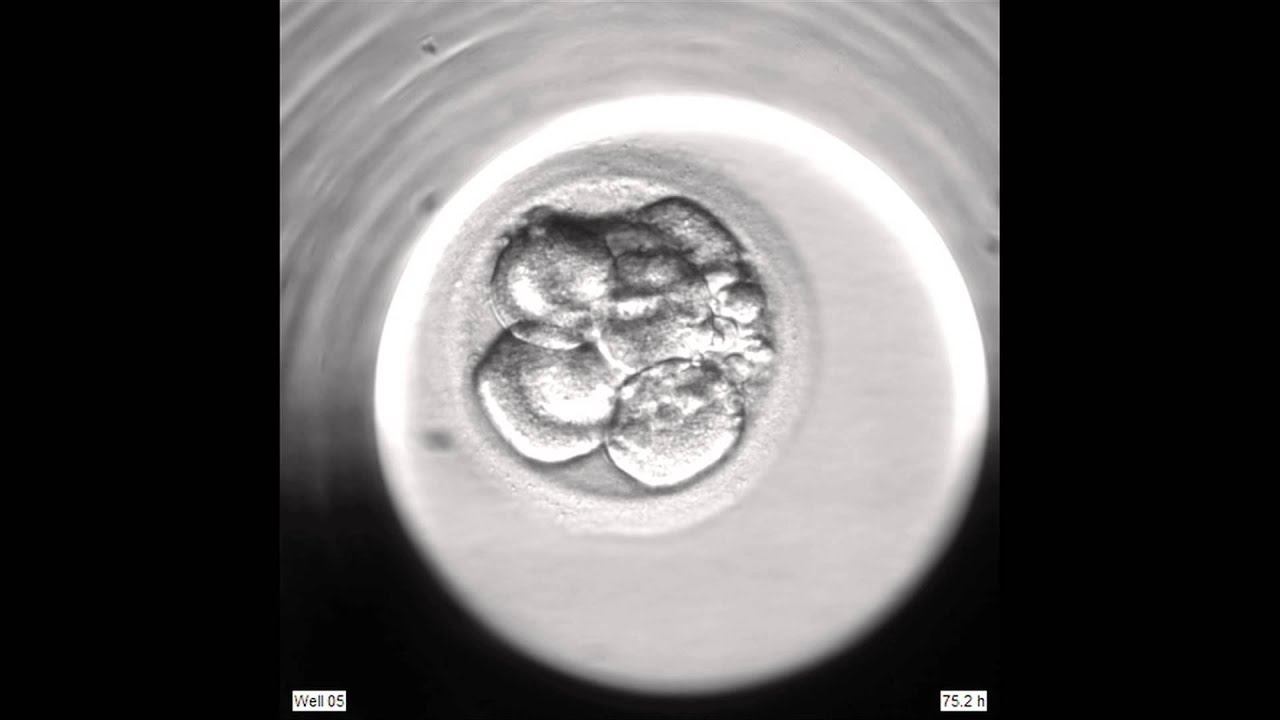 Development of an Embryo from 2PN to Blastocyst via an EmbryoScope смотреть онлайн