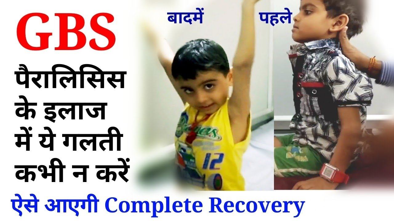 gbs physiotherapy treatment || paralysis exercise for hand and leg || guillain barre syndrome. смотреть онлайн