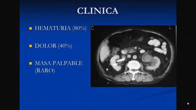 Tmmed Urología - 2 9 смотреть онлайн