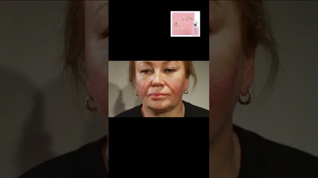 Стройность.Липолитик.