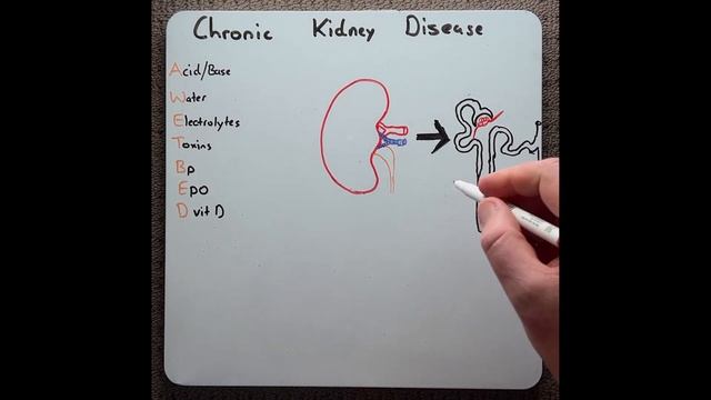 Chronic Kidney Disease | Causes and Clinical Manifestations - in 2 mins! смотреть онлайн