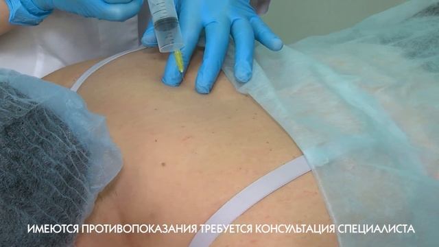 ОЗОНОТЕРАПИЯ смотреть онлайн
