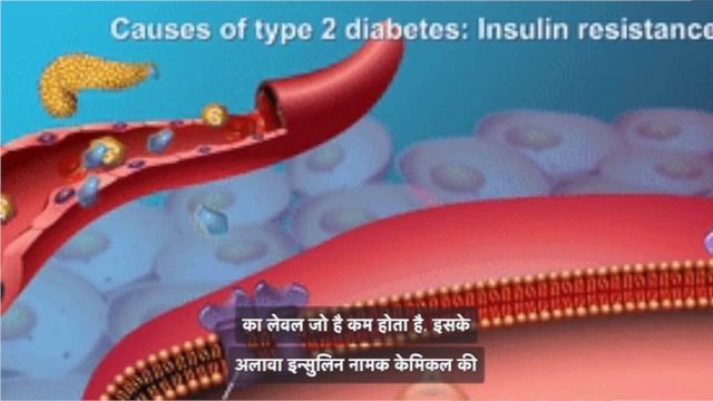Metsmall VX Metformin + Vildagliptin हाई ग्लूकोस या शुगर की बिमारी को सही करने की दवा ? #diabetes