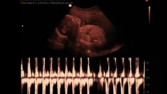 Maria Ester Princesa! смотреть онлайн