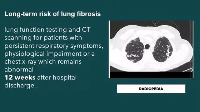 POST COVID PULM AFFECTION Dr M Fathi смотреть онлайн