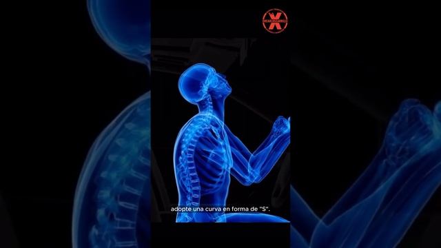 Esguince Cervical смотреть онлайн