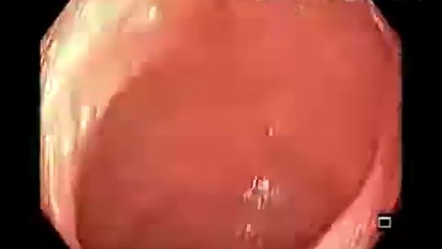 Иванова 3 смотреть онлайн