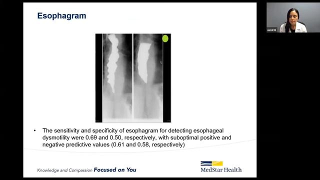 Esophageal Motility and Physiologic Testing смотреть онлайн