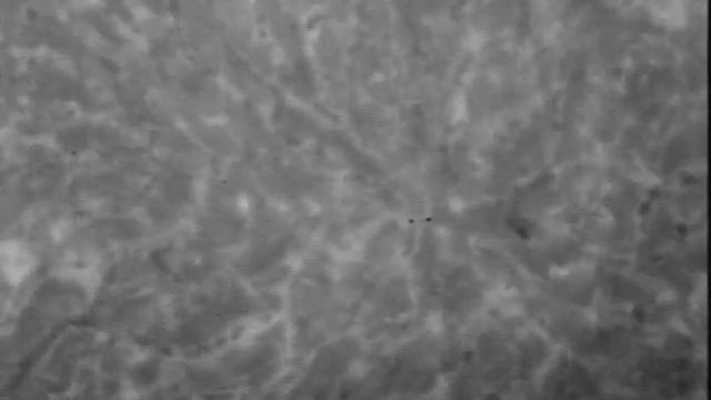 icm ivvm normal liver a3 4 смотреть онлайн