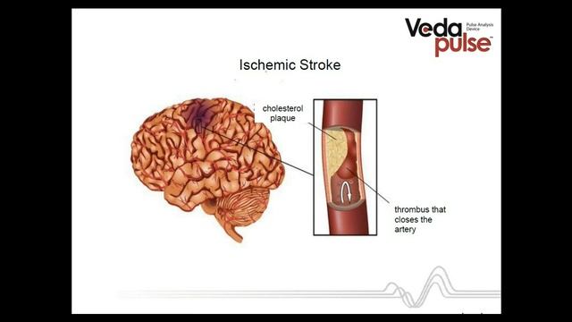 Blood coagulation смотреть онлайн