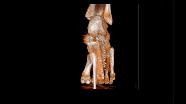 Doctor, why do my feet always hurt? смотреть онлайн