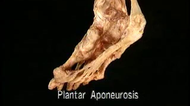 Acland's DVD Atlas of Human Anatomy DVD 2: The Lower Extremity смотреть онлайн