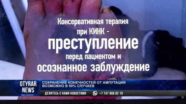 Спасение ног от ампутации при варикозе и диабете в Шымкенте смотреть онлайн