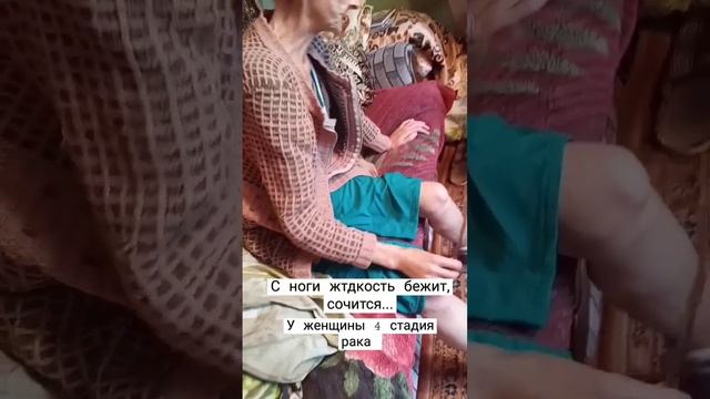 из ноги вытекает жидкость.... жесть смотреть онлайн