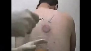 Как стать Хаджамом. Подробное описание Хиджамы. Как делать Хиджаму