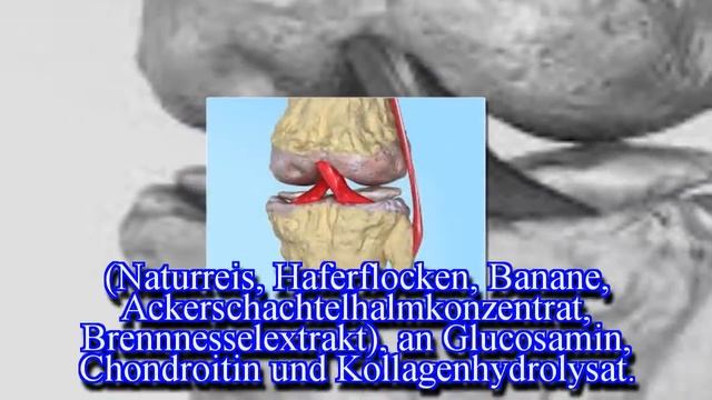 In 100 Tagen schmerzfrei – Neue Wege bei Arthrose смотреть онлайн