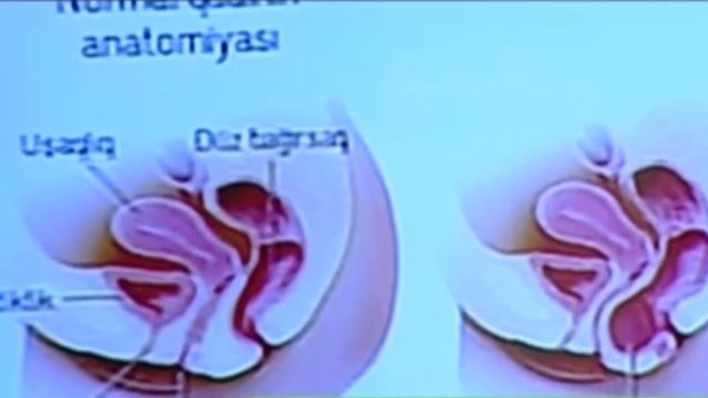 Babasili Özü Müalicə Edib Şam Qoydu - 10 Günə... смотреть онлайн