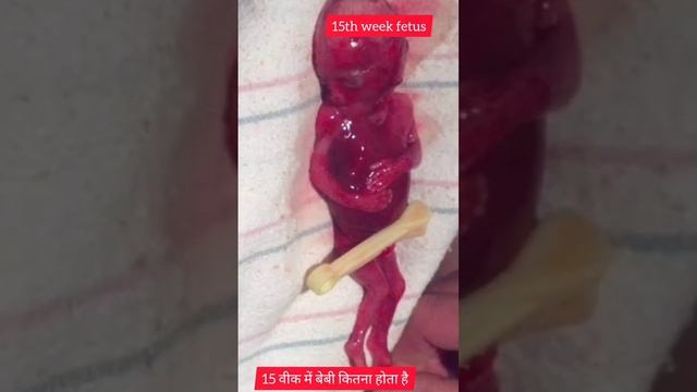 Real images of 15th week baby fetus || #pregnancy #15thweekbaby #short смотреть онлайн