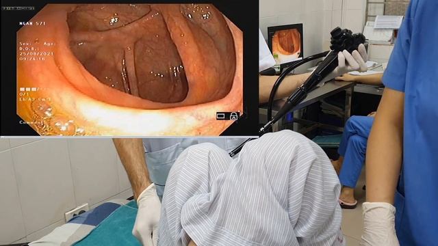 Nội soi đại tràng: tạo không khí gần gũi trong cuộc soi смотреть онлайн