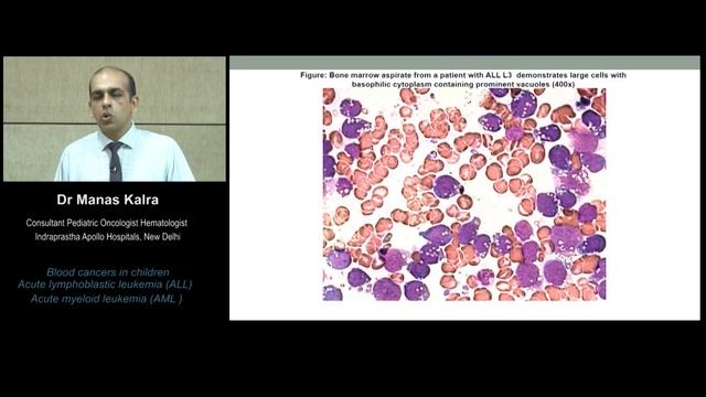 Blood cancers in children | Dr. Manas Kalra shares his views смотреть онлайн