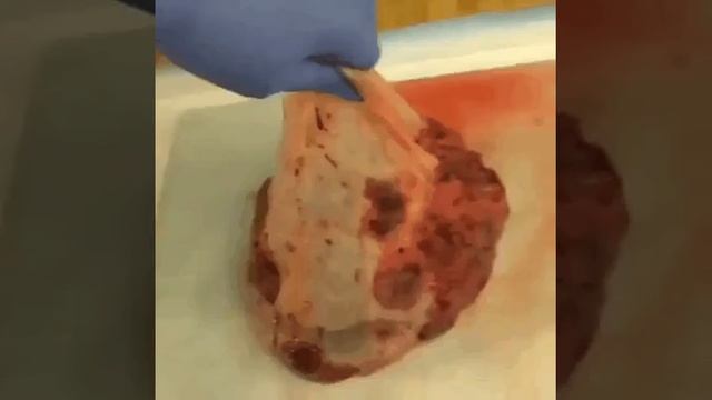 Как выглядит плацента из нутри взгляд внутрь что там околоплодные чистые воды что там ещё смотреть онлайн